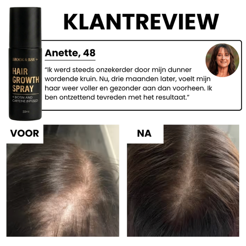 Hair Growth Spray Formule